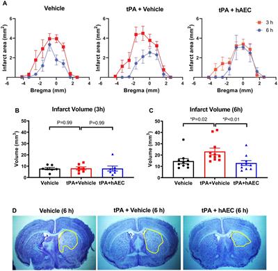 Protection against brain injury after ischemic stroke by intravenous human amnion epithelial cells in combination with tissue plasminogen activator